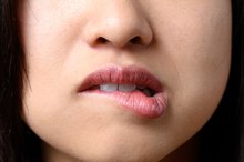 How to Make a Cold Sore Pop Fast