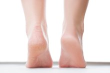 破裂的高跟鞋与营养缺陷有何相关联