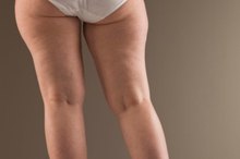 The Best Ways to Hide Cellulite on the Legs