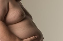 Exercises for an Obese Belly Overhang in a Man