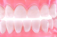 How to Clean Dentures That Have Soft Reline
