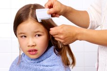 The Effects of Dandruff Shampoo on Lice
