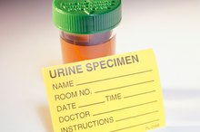 Abnormal Urine Analysis
