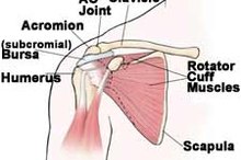 Pain Management After Rotator Cuff Surgery