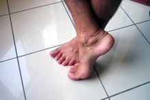 Early Signs of Dry Gangrene