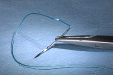 内部使用的外科钉书针的类型