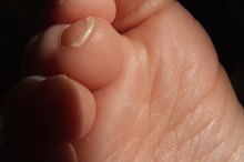 How to Cure Tingling Pain in the Foot
