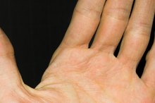 Causes of Numbness & Pain in the Left Hand