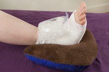 How Do I Wrap a Sprained Ankle?