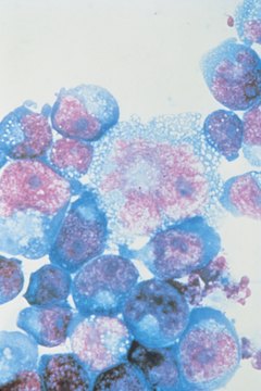 Comstock/Comstock/Getty Images Viruses are complex organisms that damage healthy cells in the human body.