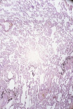 Duncan Smith/Photodisc/Getty Images Finding a cancer cell can kick off a long, expensive medical journey.