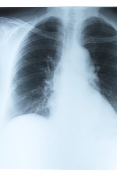 Hemera Technologies/AbleStock.com/Getty Images Pain in your ribs can make it difficult to do almost every physical activity.
