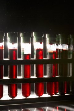 Siri Stafford/Photodisc/Getty Images Your doctor may prescribe a blood test to check your cholesterol levels.