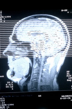 MRI technicians must complete degrees and continuing education requirements to be certified.
