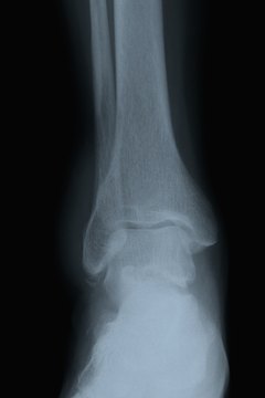 Jupiterimages/Comstock/Getty Images Potential risks to your ankle outweigh the benefits.