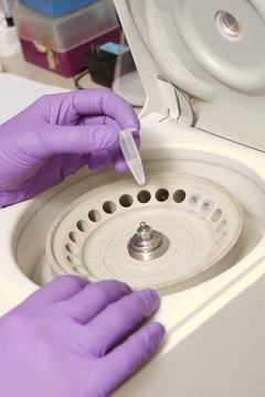 Hemera Technologies/AbleStock.com/Getty Images Epidemiologists analyze body fluids and tissue samples.
