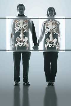Comstock/Comstock/Getty Images Phosphorus helps maintain bone health.