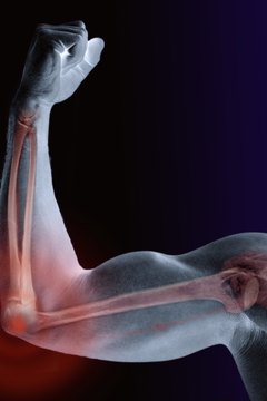 Adam Gault/Digital Vision/Getty Images Phosphorus keeps your bones strong.