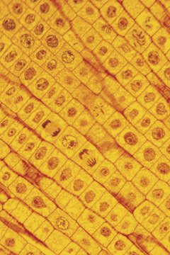 A microscope slide displaying the different phases of mitosis.