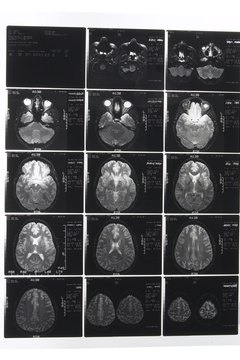 How to Get a Certificate in Radiologic Technology  Synonym