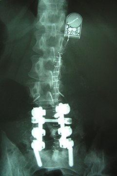 The disk protects the spinal column.