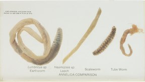 Resultado de imagen para tipos de parasitos intestinales