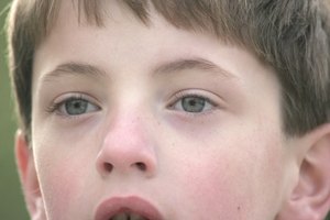 Cómo evitar el parpadeo excesivo en los niños