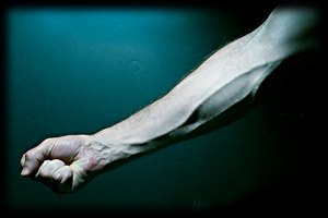 Por qué las venas se inflaman luego de una extracción de sangre