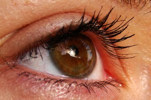 ¿Cuáles son los peligros de usar gotas para los oídos en los ojos?