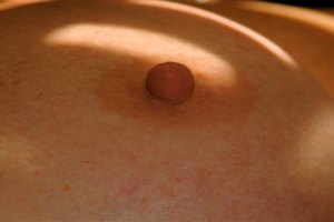 ¿Cuáles son las causas de las masas en los senos?