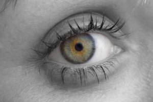 ¿Qué causa las pupilas pequeñas?