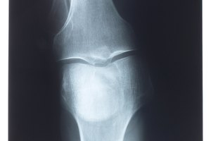 ¿Son malas para las rodillas las extensiones de pierna?