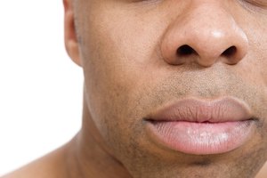 Cómo desinflamar un labio hinchado que ha quedado muy rígido