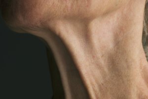 Cómo reafirmar la piel debajo del mentón después de la pérdida de peso
