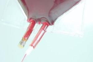 ¿Cómo funciona una prueba de sangre cuantitativa?