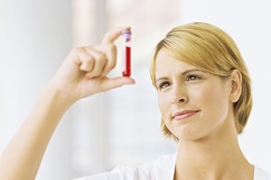 Pruebas de sangre para la función de la glándula suprarrenal