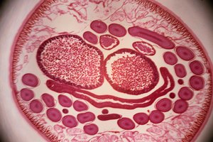 Cuáles son los signos de la presencia de lombrices en la materia fecal