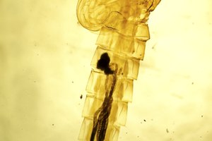 Curas para los parásitos del cerebro humano