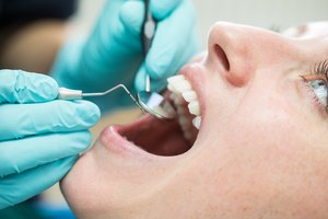 ¿Cuánto cuesta un tratamiento de conducto sin seguro dental?