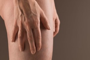 ¿La celulitis se va con el ejercicio?