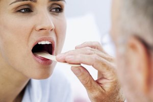 Signos de VPH en la garganta