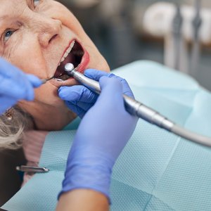 Financial Help for Low Income Seniors for Dental Work