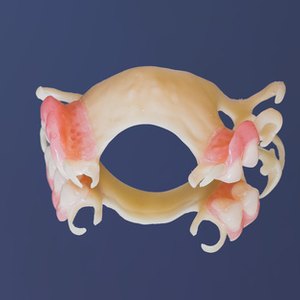 Does Medicaid Pay for Dentures?