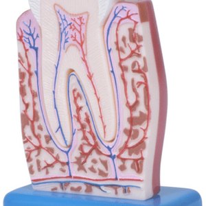 Wisdom Teeth Extraction With No Insurance