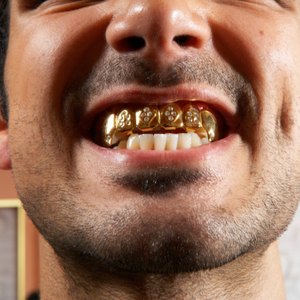How to Recover Dental Gold