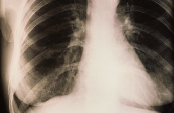 test monitor heart Between and Difference Congestive Right Heart Left Failure