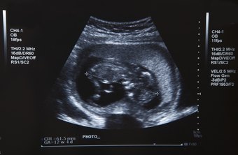 qualifications for a medical sonographer chron com qualifications for medical