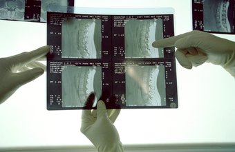 Medical coders bill for X-rays and other services in a medical facility.