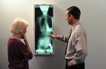 Image result for Use Of Chiropractic Treatment For Scoliosis