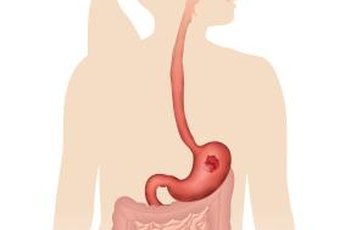 Fats require special processing before absorption from your digestive system.